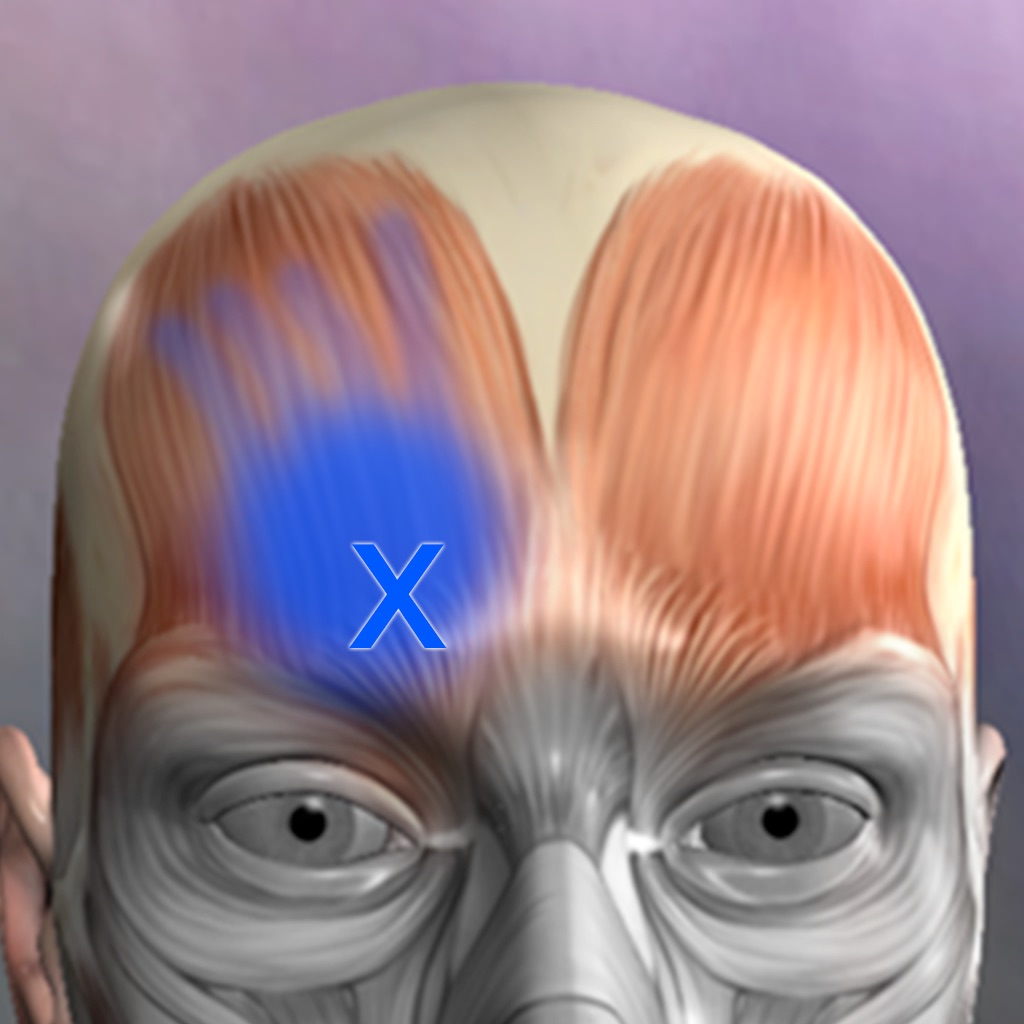 Muscle Trigger Points app icon