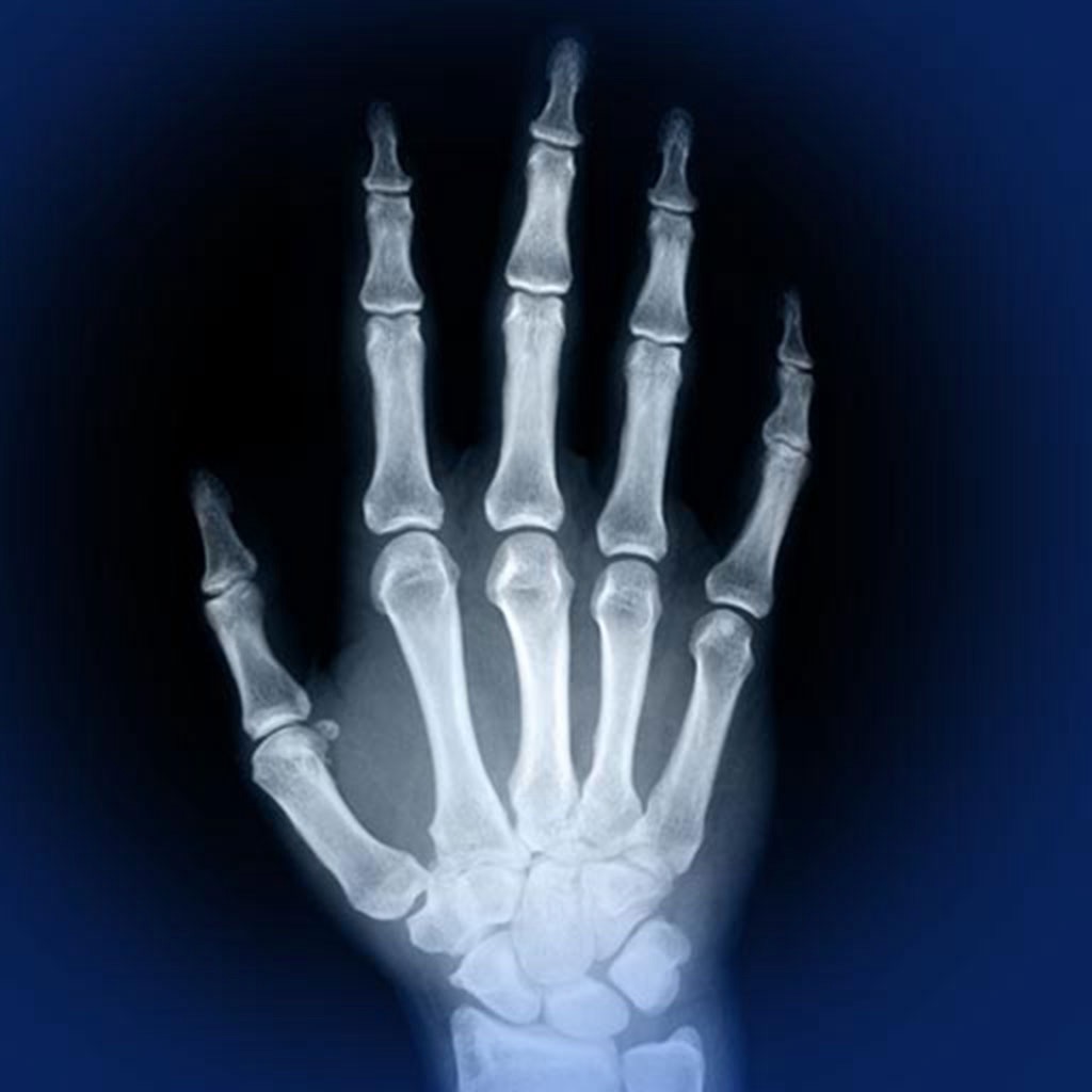 Skeletal Anatomy 3D app icon